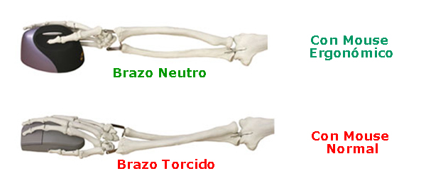Mouse_ergonomico_EM2420_huesos_1.jpg